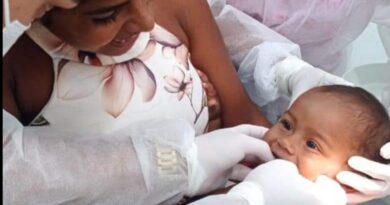 Prefeitura de Tefé realiza cirurgia de língua presa em crianças
